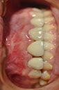 %_tempFileNameImplant%2095e4%