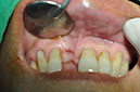 %_tempFileNameImplant%2096a2%
