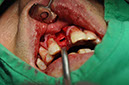 %_tempFileNameImplant%2096a5%