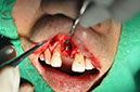 %_tempFileNameImplant%2096b1%