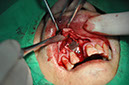 %_tempFileNameImplant%2096b2%