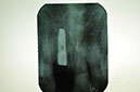 %_tempFileNameImplant%2096b3%