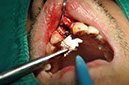 %_tempFileNameImplant%2096c2%