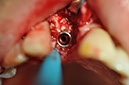 %_tempFileNameImplant%2096c3%