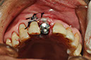%_tempFileNameImplant%2096c4%