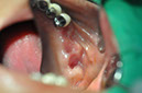 %_tempFileNameImplant%2098a1%