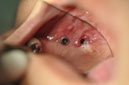 %_tempFileNameImplant%2098b1%