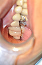 %_tempFileNameImplant%2098c2%