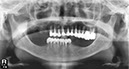 %_tempFileNameImplant%2098d1%