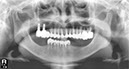 %_tempFileNameImplant%2098d2%