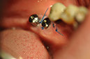 %_tempFileNameImplant%2099a1%