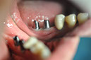%_tempFileNameImplant%2099b2%