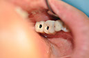 %_tempFileNameImplant%2099c4%