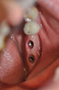 %_tempFileNameImplant%2099c5%