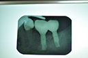%_tempFileNameImplant%2099d2%