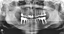%_tempFileNameImplant%2099d3%