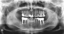 %_tempFileNameImplant%2099d5%
