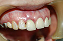 %_tempFileNameImplant%209a4%