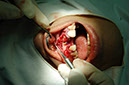 %_tempFileNameImplant%209d1%