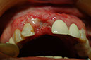 %_tempFileNameImplant%209g5%