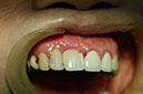 %_tempFileNameImplant%209h1%