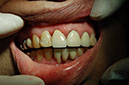 %_tempFileNameImplant%209j1%