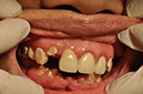 %_tempFileNameImplant%209j2%