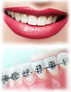 Implant 83 陳X二