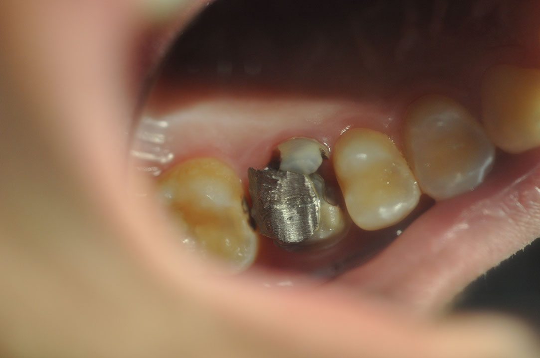 %_tempFileNameIMplant%20108a1%