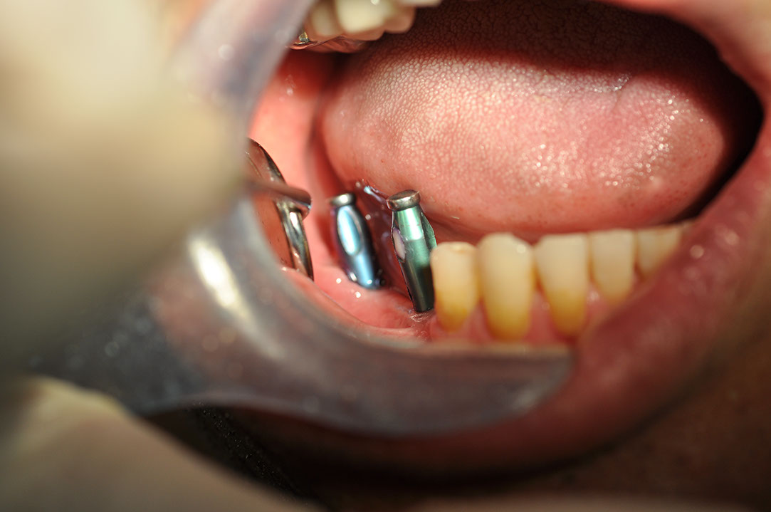 %_tempFileNameIMplant%2040c5%