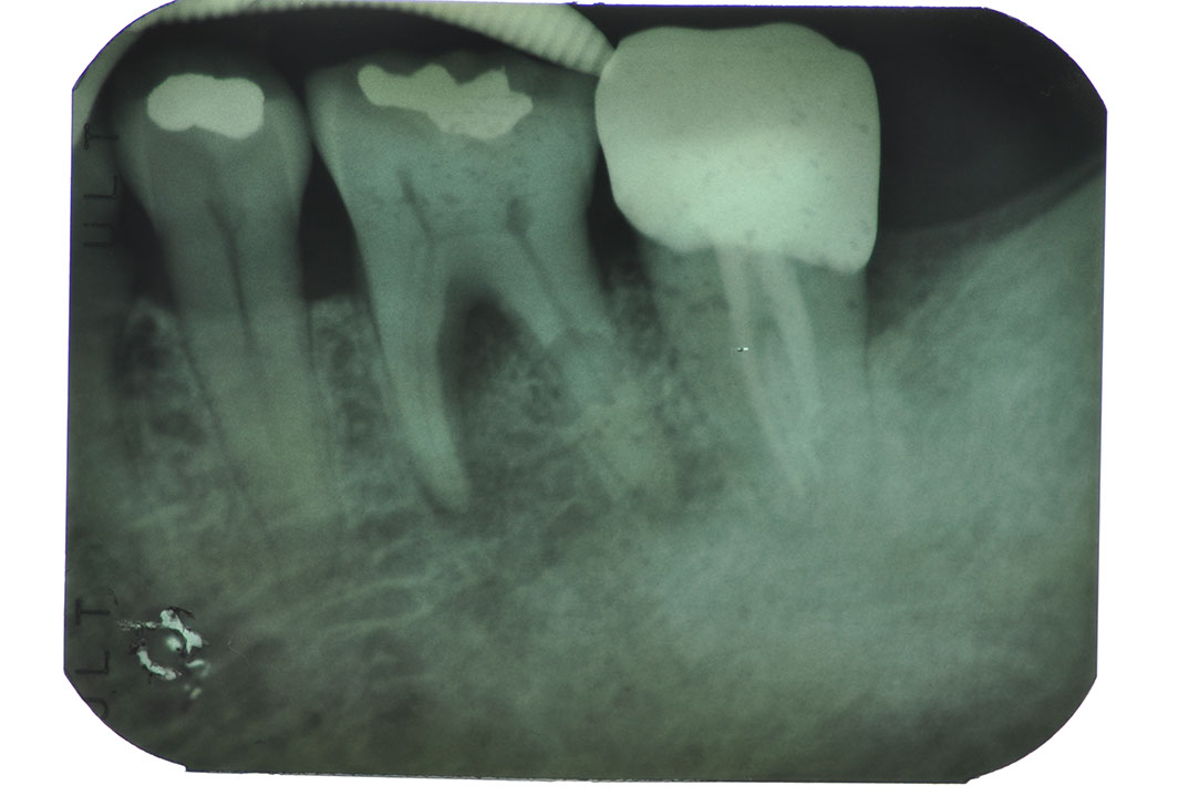 %_tempFileNameImplant%20104a1%