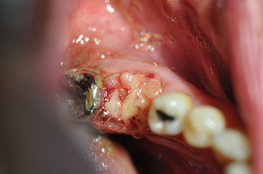 %_tempFileNameImplant%20104a5%