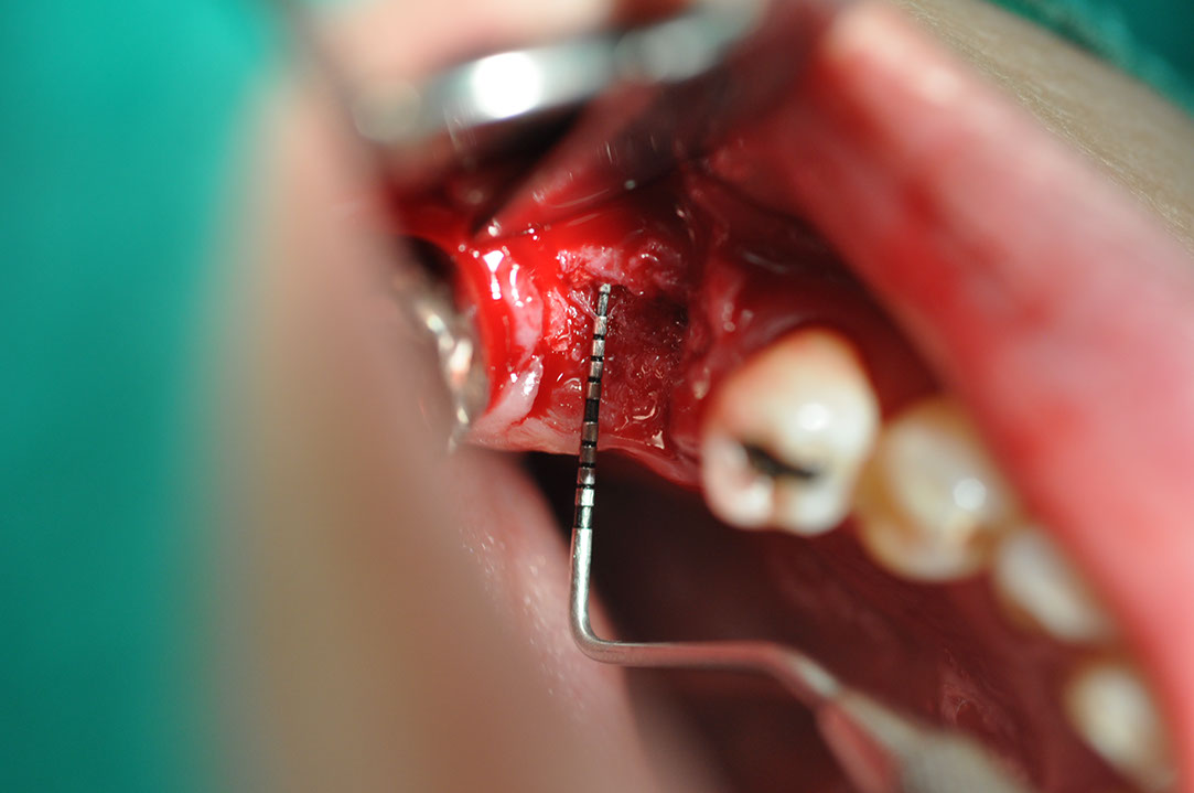 %_tempFileNameImplant%20104a9%