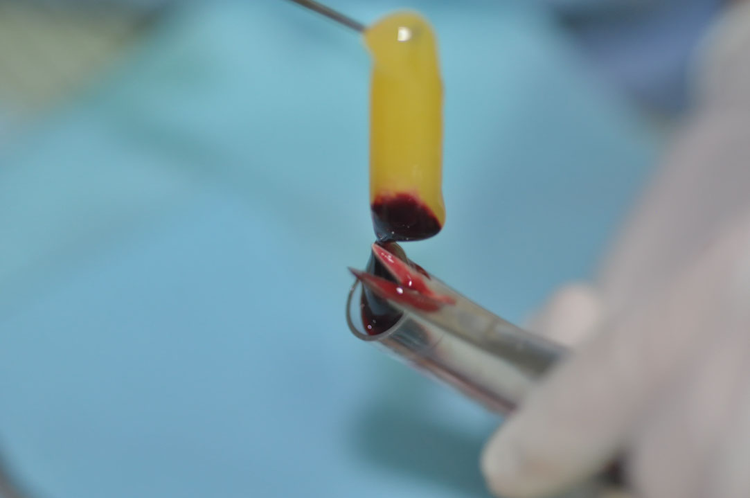 %_tempFileNameImplant%20104b2%