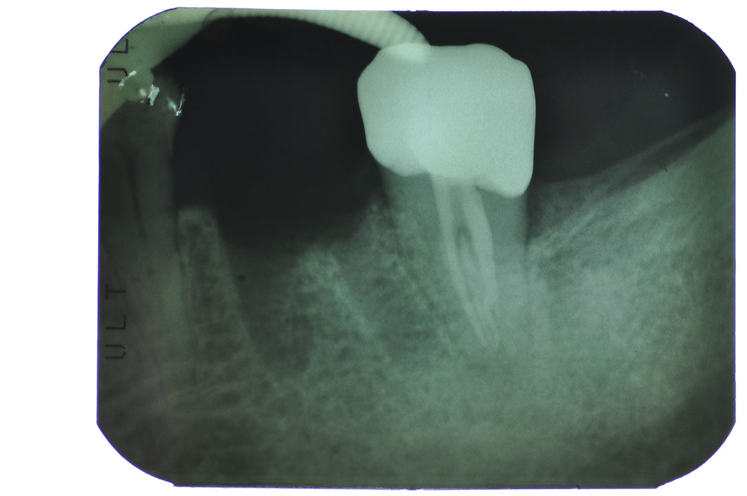 %_tempFileNameImplant%20104d1%