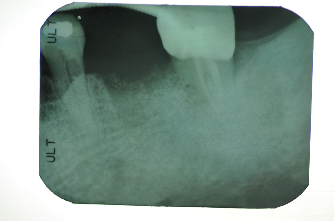 %_tempFileNameImplant%20104d3%