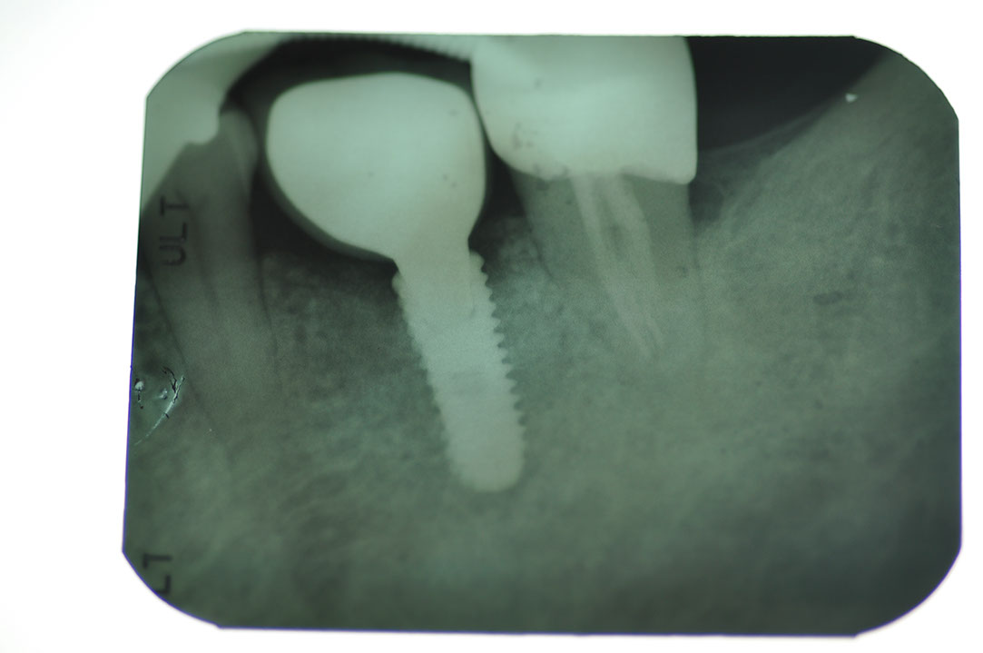 %_tempFileNameImplant%20104d5%