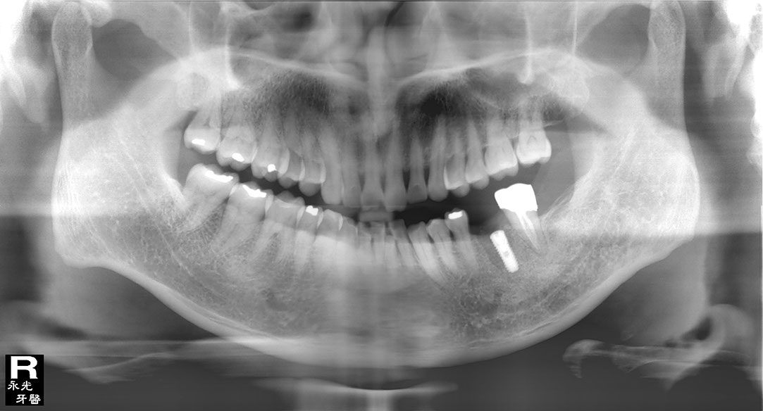 %_tempFileNameImplant%20104d7%