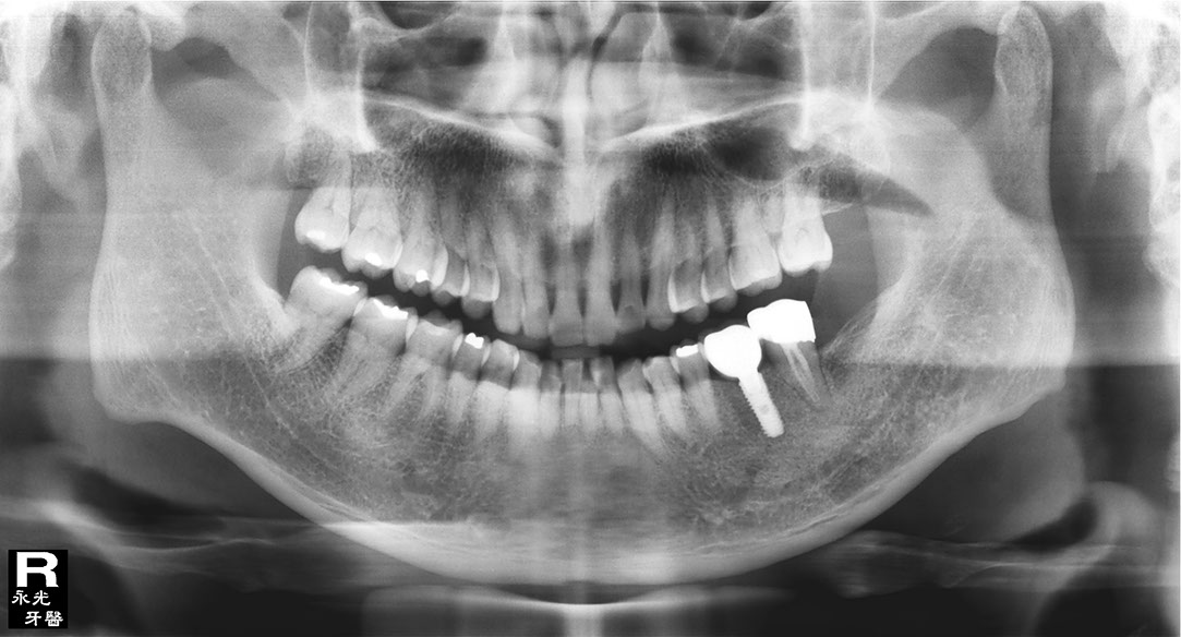 %_tempFileNameImplant%20104d8%