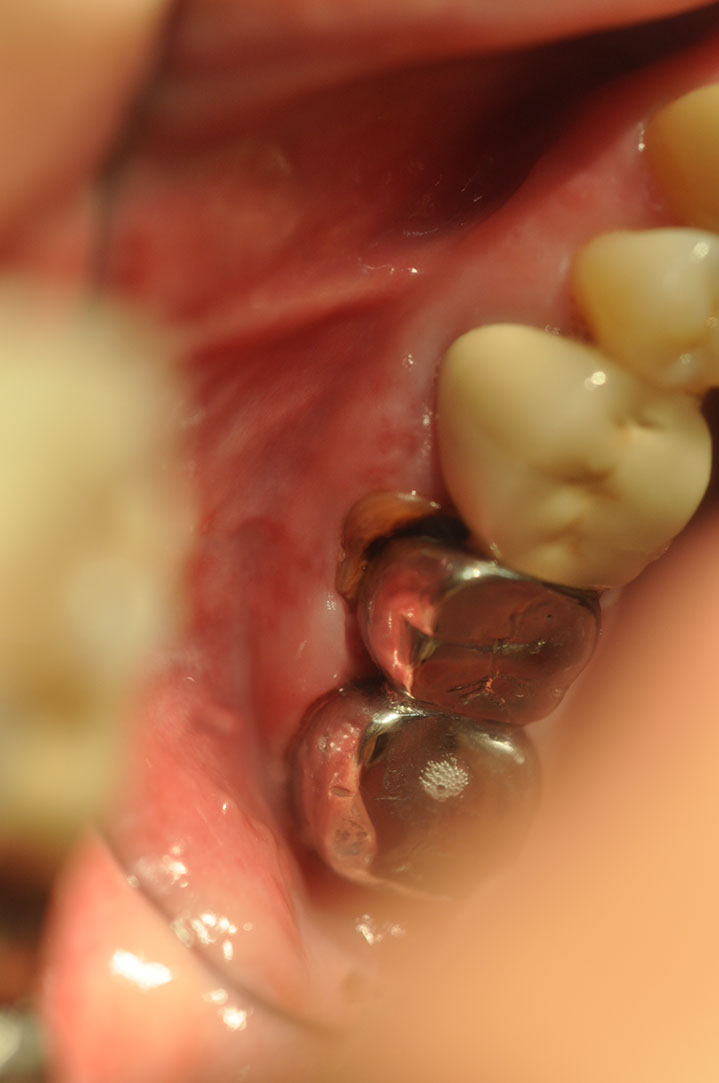 %_tempFileNameImplant%20105a1%