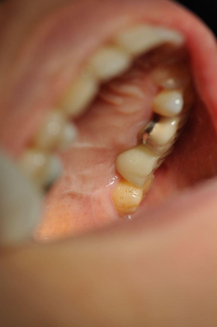 %_tempFileNameImplant%20105c2%