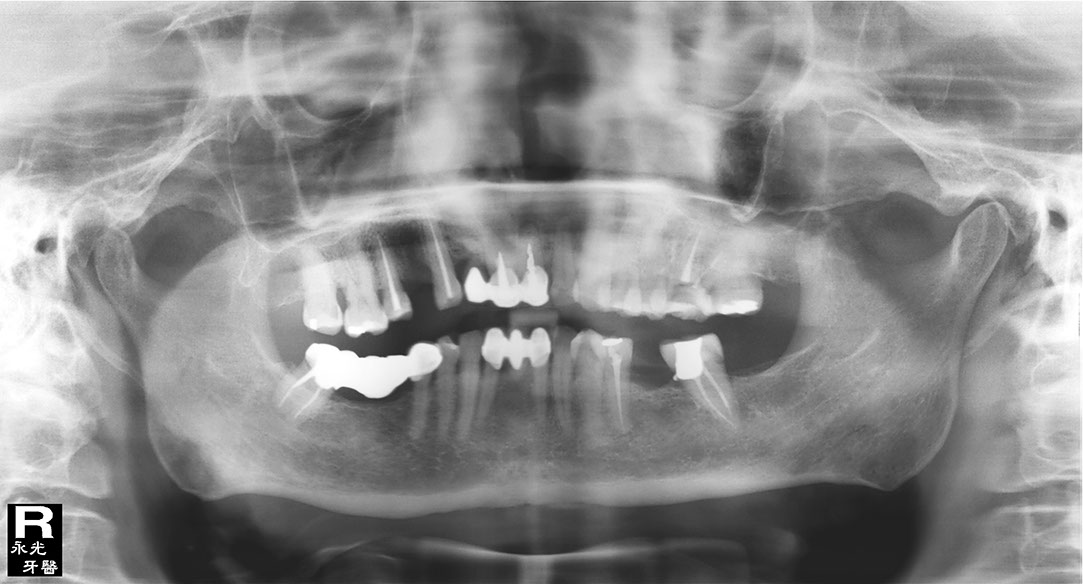 %_tempFileNameImplant%20107a2%
