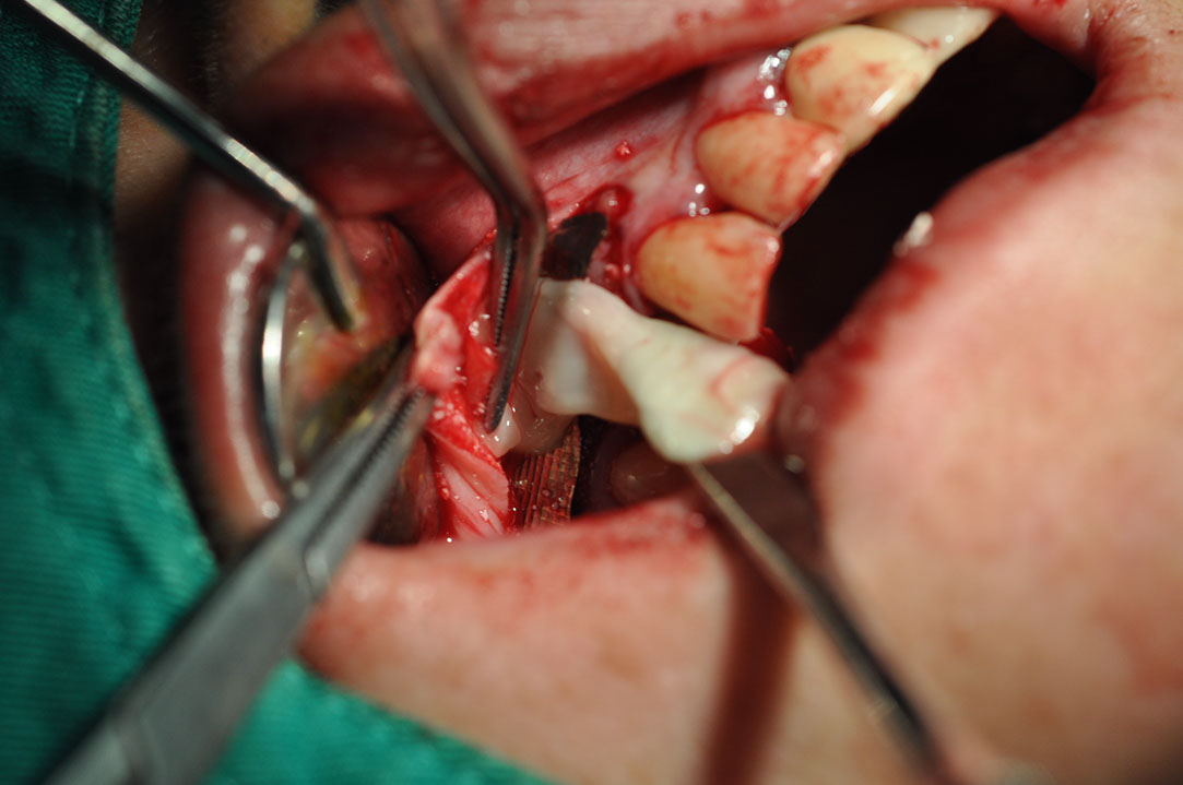 %_tempFileNameImplant%20107b3%