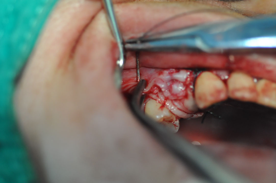 %_tempFileNameImplant%20107b5%