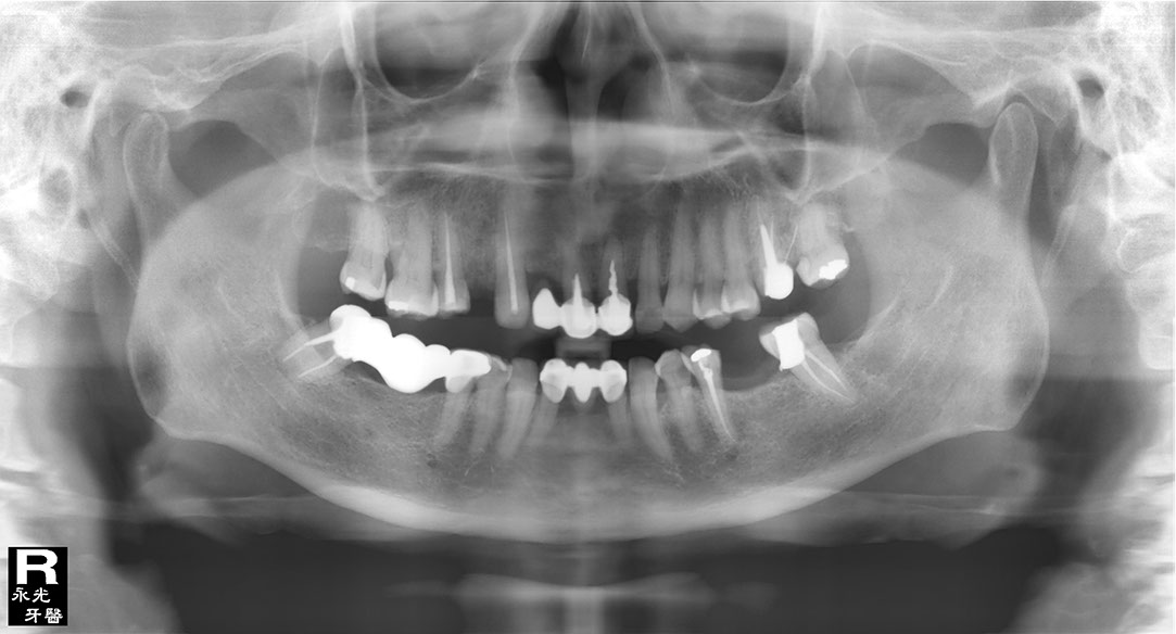 %_tempFileNameImplant%20107b7%