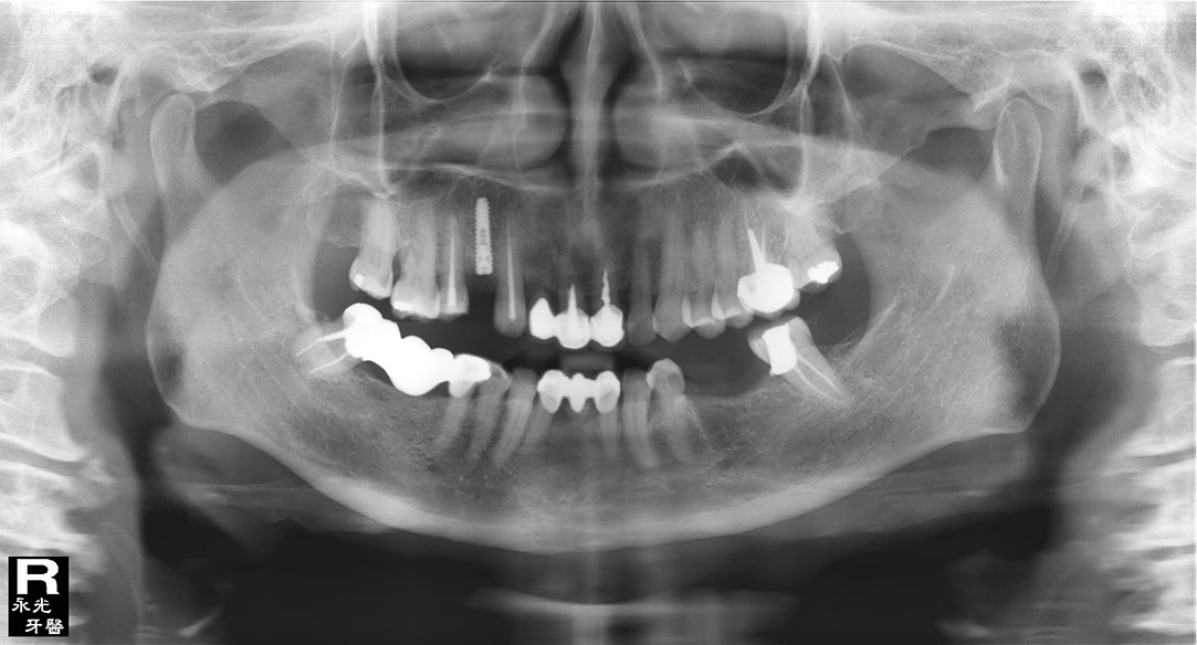 %_tempFileNameImplant%20107c8%