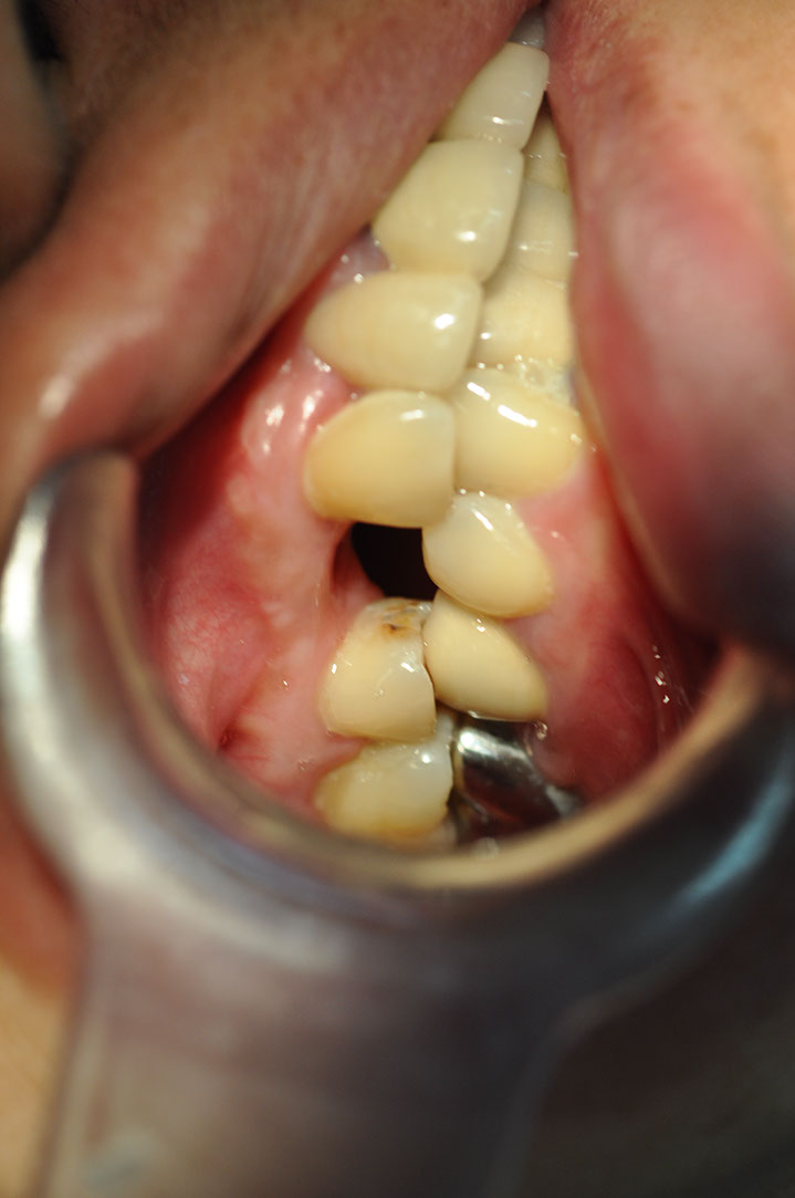 %_tempFileNameImplant%20107d6%