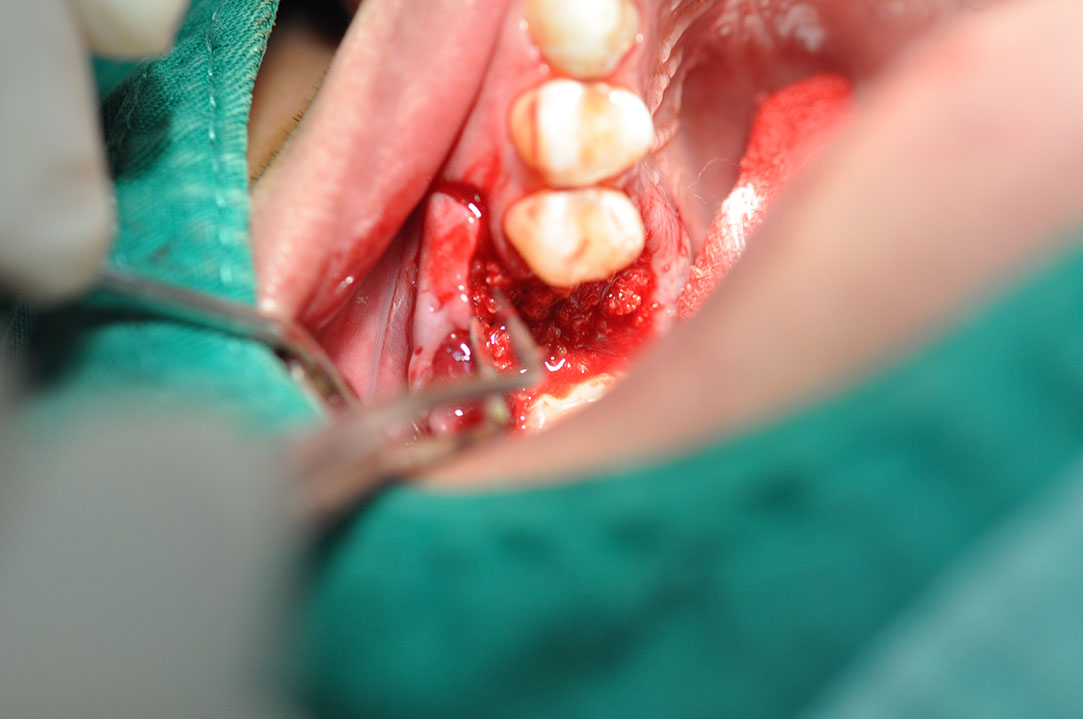 %_tempFileNameImplant%20108b1%