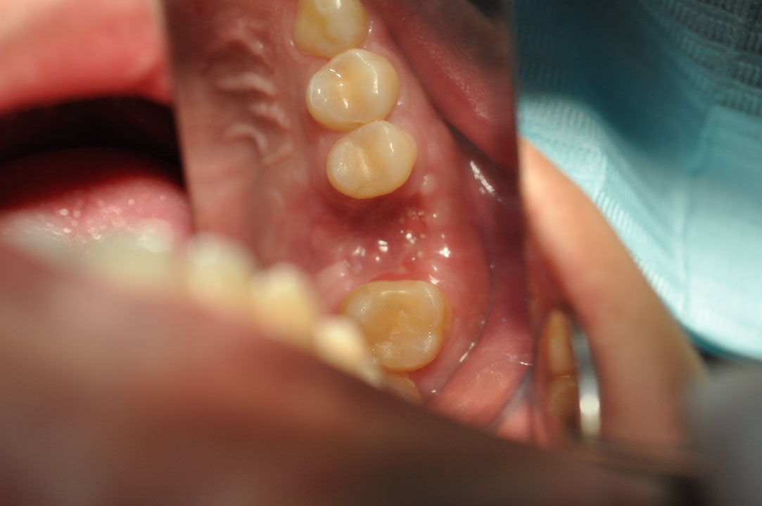 %_tempFileNameImplant%20108b4%