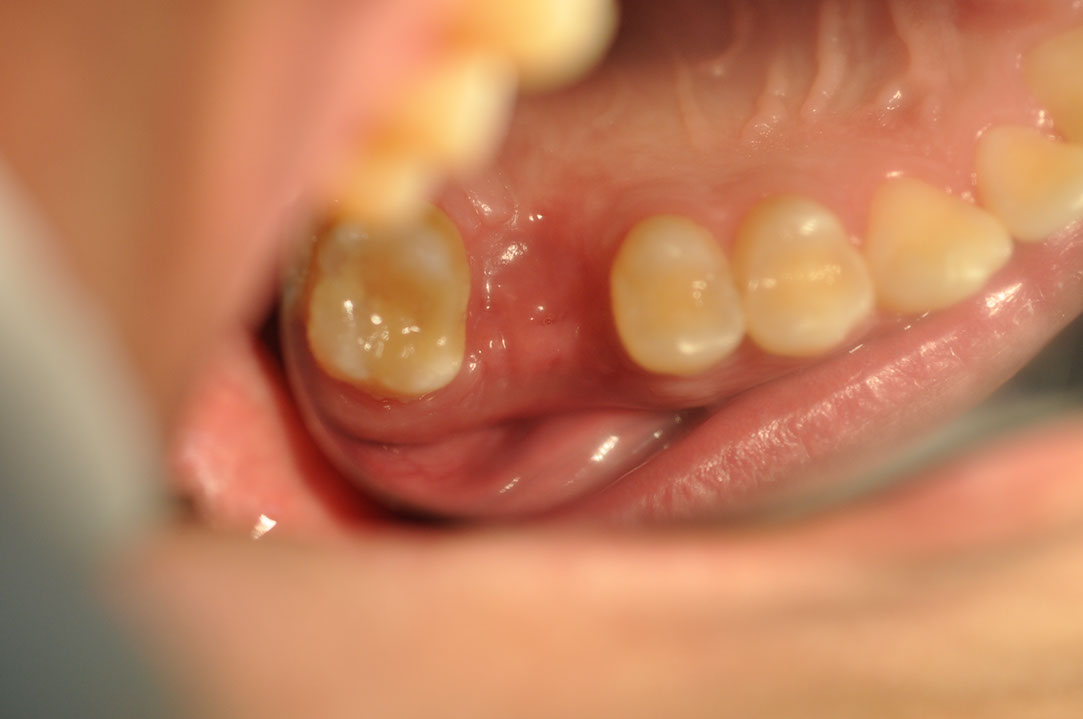 %_tempFileNameImplant%20108b9%